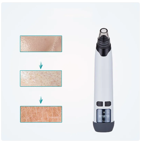 Urban Trendly Blackhead Remover Vacuum Pore Cleanser