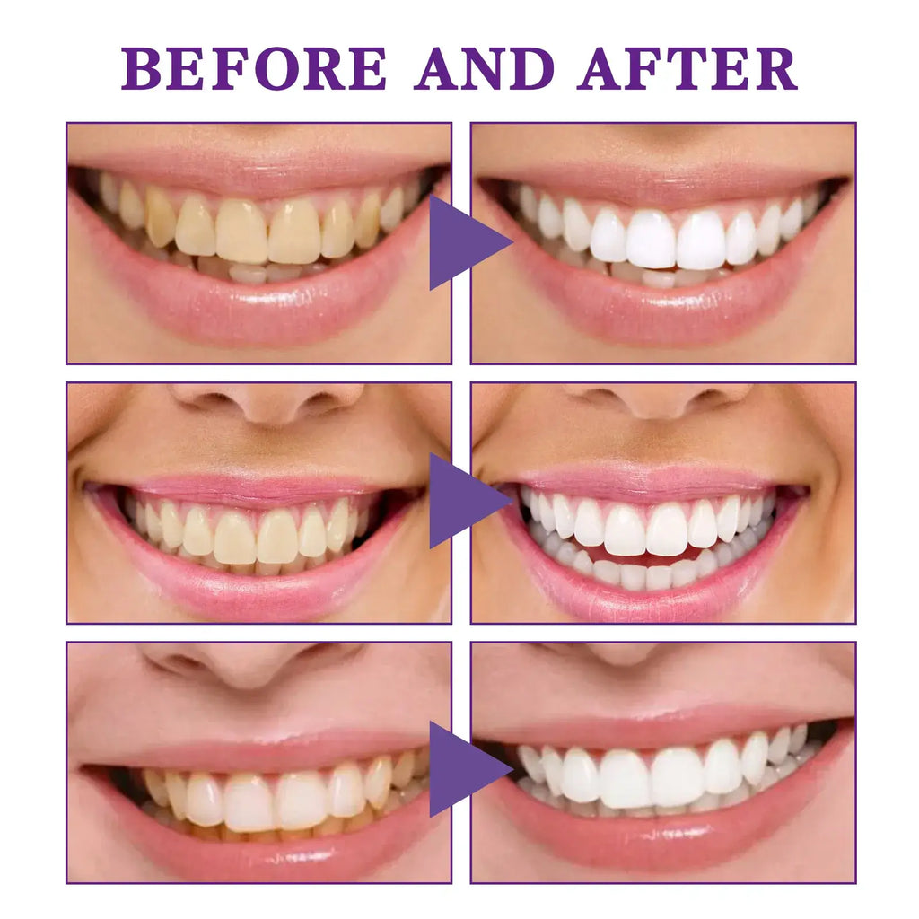 Urban Trendly V34 Tooth Cleaning Mousse Whitening Foam